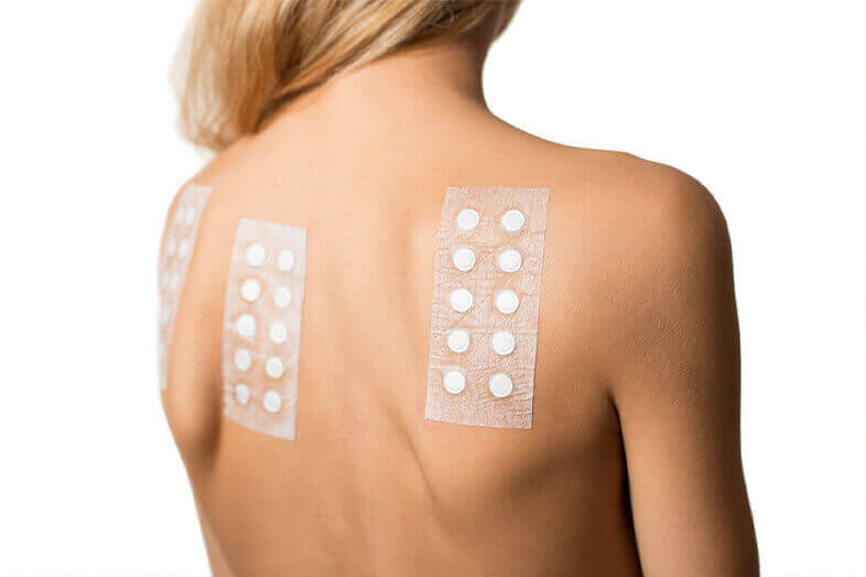 woman with patch testing on her back