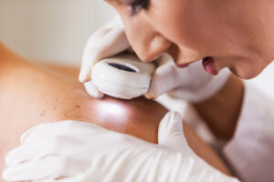 Doctor examining a patient's skin