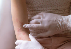 Dermatologist examines patient skin rashes